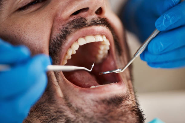Best Knocked-Out Tooth Emergency  in Red Bank, SC